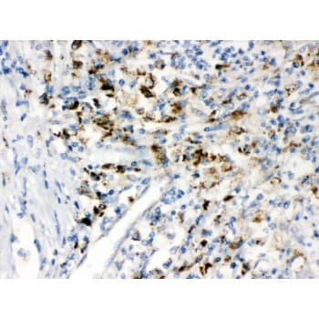 Polyclonal Rabbit anti-Human PPT1 / CLN1 Antibody (aa191-224, IHC, WB)
