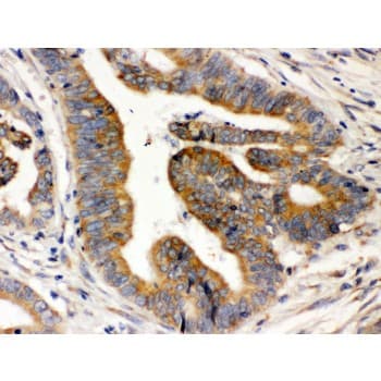 Polyclonal Rabbit anti-Human RAB5A / RAB5 Antibody (aa179-215, IHC, WB)