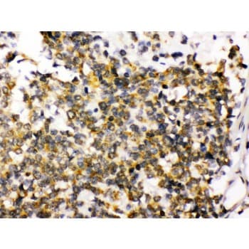 Polyclonal Rabbit anti-Human DLG4 / PSD95 Antibody (aa581-724, IHC, WB)