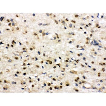Polyclonal Rabbit anti-Human DLG4 / PSD95 Antibody (aa581-724, IHC, WB)