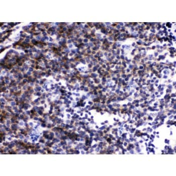 p56lck / LCK Antibody (aa468-506)