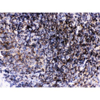 p56lck / LCK Antibody (aa468-506)