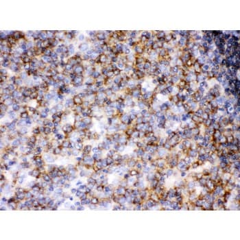 p56lck / LCK Antibody (aa468-506)
