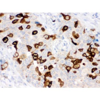 Polyclonal Rabbit anti-Human RRM2 Antibody (aa1-33, IHC, WB)