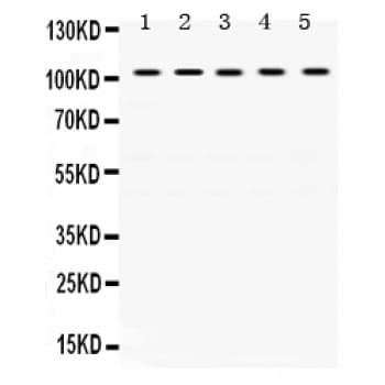 Polyclonal Rabbit anti-Human TRIM28 / KAP1 Antibody (aa699-835, IHC, WB)
