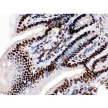 Polyclonal Rabbit anti-Human TRIM28 / KAP1 Antibody (aa699-835, IHC, WB)