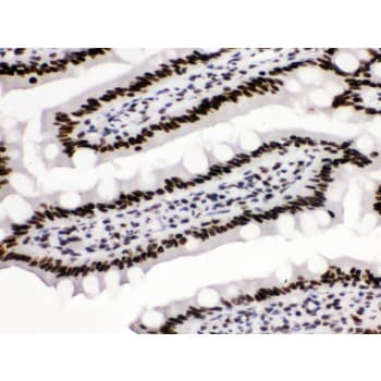 Polyclonal Rabbit anti-Human TRIM28 / KAP1 Antibody (aa699-835, IHC, WB)