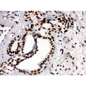 Polyclonal Rabbit anti-Human TRIM28 / KAP1 Antibody (aa699-835, IHC, WB)
