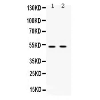 Polyclonal Rabbit anti-Human UBA3 / UBE1C Antibody (aa409-448, IHC, WB)