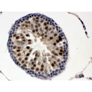 Polyclonal Rabbit anti-Human UBA3 / UBE1C Antibody (aa409-448, IHC, WB)