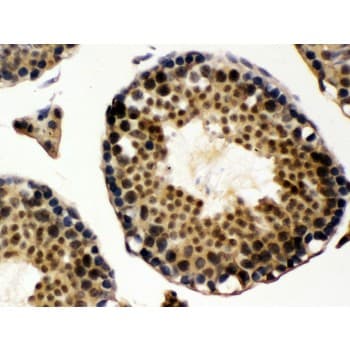 Polyclonal Rabbit anti-Human UBA3 / UBE1C Antibody (aa409-448, IHC, WB)