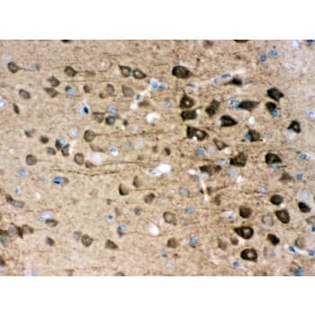 UCHL1 / PGP9.5 Antibody (aa120-153)
