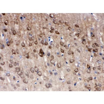 UCHL1 / PGP9.5 Antibody (aa120-153)