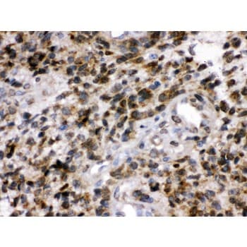 UCHL1 / PGP9.5 Antibody (aa120-153)