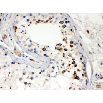 DIABLO / SMAC Antibody (aa56-239)