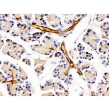 PPP1R1B / DARPP-32 Antibody (aa1-36)