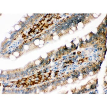 PPP1R1B / DARPP-32 Antibody (aa1-36)