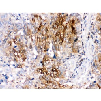 PPP1R1B / DARPP-32 Antibody (aa1-36)