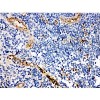 Polyclonal Rabbit anti-Human CD59 Antibody (aa26-102, IHC)