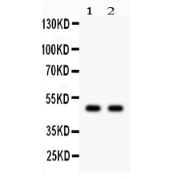 MAPK9 / JNK2 Antibody (aa257-288)