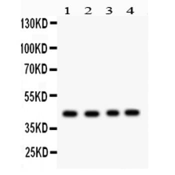 Polyclonal Rabbit anti-Human TSG101 Antibody (aa361-390, WB)