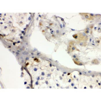 Polyclonal Rabbit anti-Human DMRT1 Antibody (aa98-128, IHC, WB)