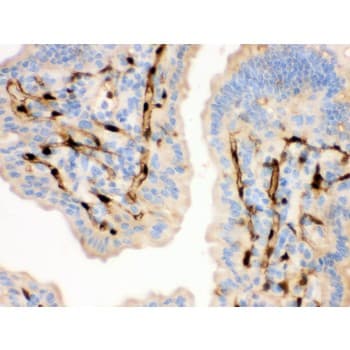 Polyclonal Rabbit anti-Human FABP4 / AP2 Antibody (aa10-40, IHC, WB)
