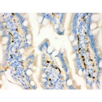 Polyclonal Rabbit anti-Human FABP4 / AP2 Antibody (aa10-40, IHC, WB)