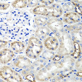 Polyclonal Rabbit anti-Human TNFAIP6 / TSG-6 Antibody (IHC, WB)
