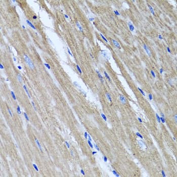Polyclonal Rabbit anti-Human TNFAIP6 / TSG-6 Antibody (IHC, WB)