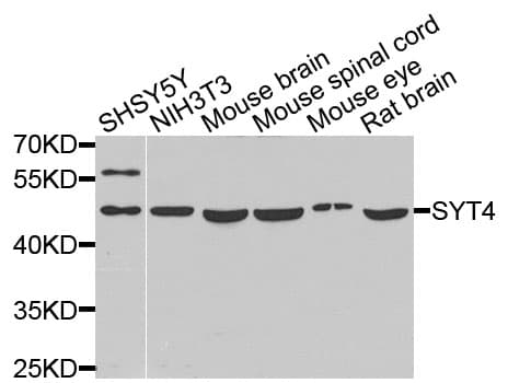 Polyclonal Rabbit anti-Human SYT4 Antibody (IHC, WB)
