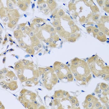 Polyclonal Rabbit anti-Human SYT4 Antibody (IHC, WB)