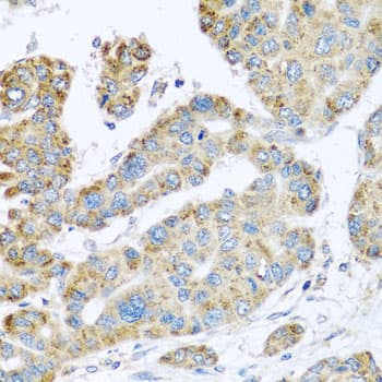 Polyclonal Rabbit anti-Human SYT4 Antibody (IHC, WB)