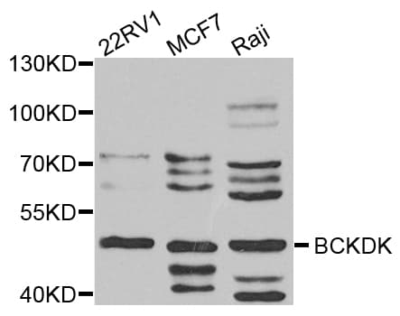 Polyclonal Rabbit anti-Human BCKDK Antibody (IHC, WB)