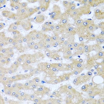 Polyclonal Rabbit anti-Human BCKDK Antibody (IHC, WB)