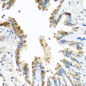 Polyclonal Rabbit anti-Human BCKDK Antibody (IHC, WB)