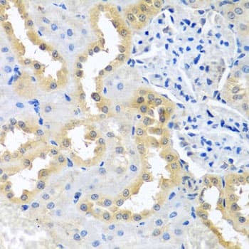 Polyclonal Rabbit anti-Human BCKDK Antibody (IHC, WB)