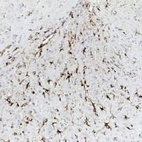 GFAP Antibody