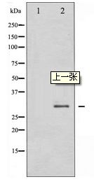 SNAI1 / SNAIL-1 Antibody