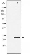 Polyclonal Rabbit anti-Human CAV1 / Caveolin 1 Antibody (WB)