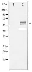 Polyclonal Rabbit anti-Human LIPE / HSL Antibody (IHC, WB)