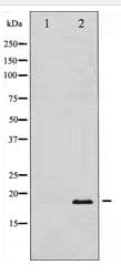 Polyclonal Rabbit anti-Human PIN1 Antibody (IF, WB)
