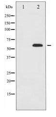 Polyclonal Rabbit anti-Human HDAC1 Antibody (IHC, WB)