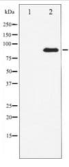 Polyclonal Rabbit anti-Human CTTN / Cortactin Antibody (IHC, WB)