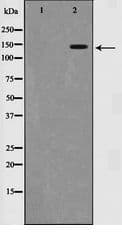 Polyclonal Rabbit anti-Human SMC1A / SMC1 Antibody (IHC, WB)