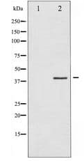 Polyclonal Rabbit anti-Human AURKB / Aurora-B Antibody (IF, WB)