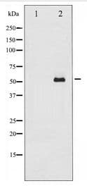 Polyclonal Rabbit anti-Human SMAD2 Antibody (IHC, IF, WB)