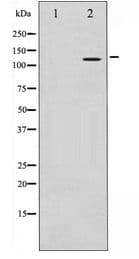 Polyclonal Rabbit anti-Human HDAC9 Antibody (IHC, IF, WB)