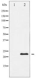 Polyclonal Rabbit anti-Human TIMP2 Antibody (IF, WB)