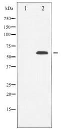 Polyclonal Rabbit anti-Human TUBB / Beta Tubulin Antibody (IHC, WB)